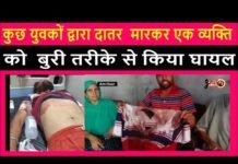 A person was badly injured after being beaten to the teeth by some youths